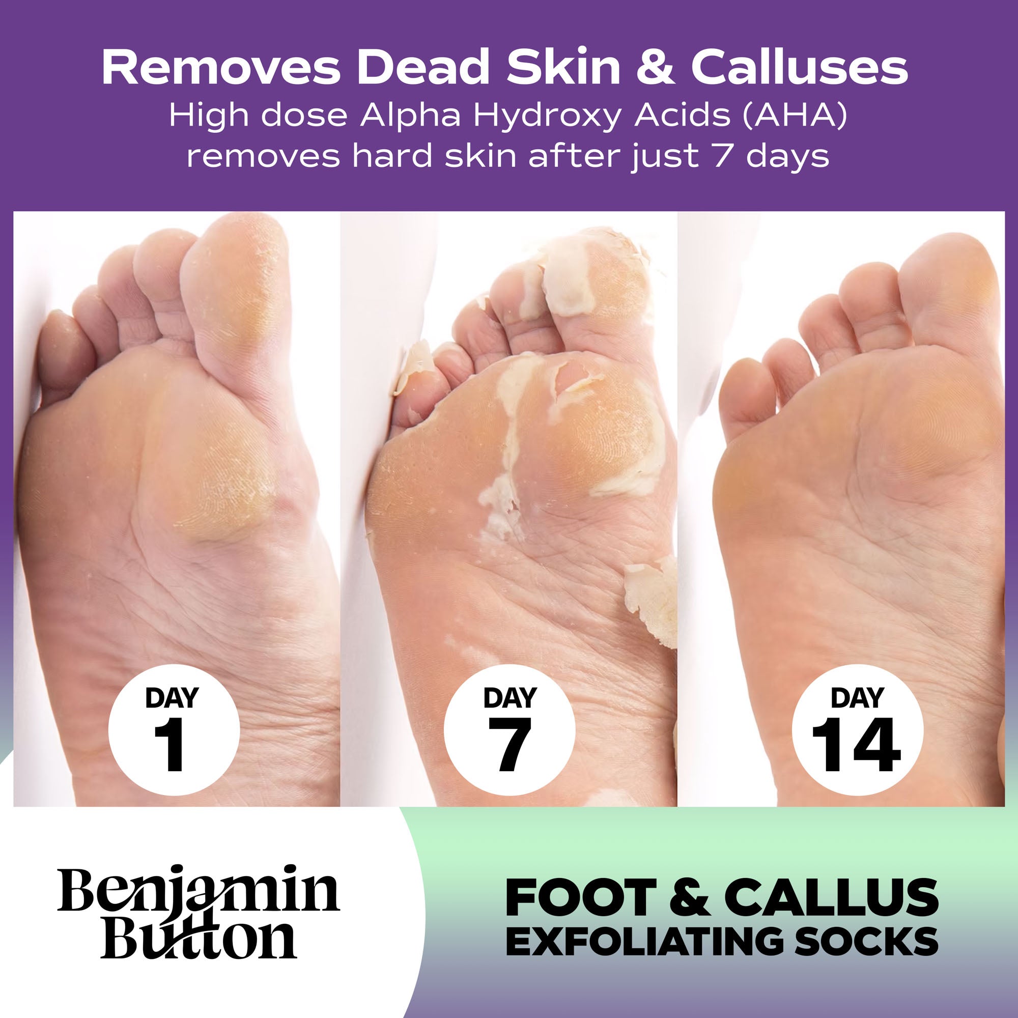 Exfoliating Foot Peel Mask – AHA Foot Peeling Socks – Single Pair