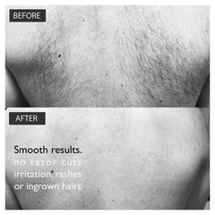 Back Hair Removal Kit for Men – Cream, Extendable Applicator & Loofah
