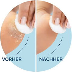 SmoothSteps Replacement Rollers