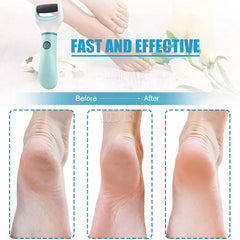 SilkySmooth Electric Foot Buffer